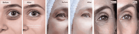 Before after